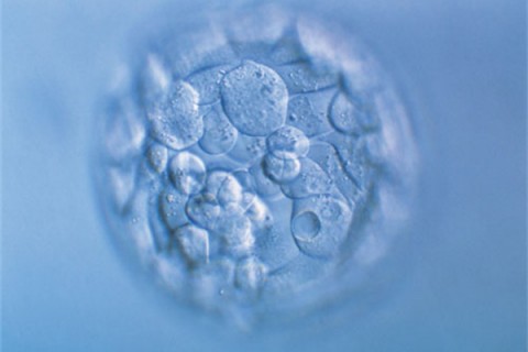http://xuzhou.quanwangkm.com/post/190.html|徐州人工试管